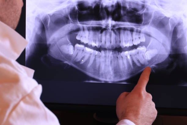 Best Emergency Dental Care for Broken or Chipped Teeth in Lacon, IL